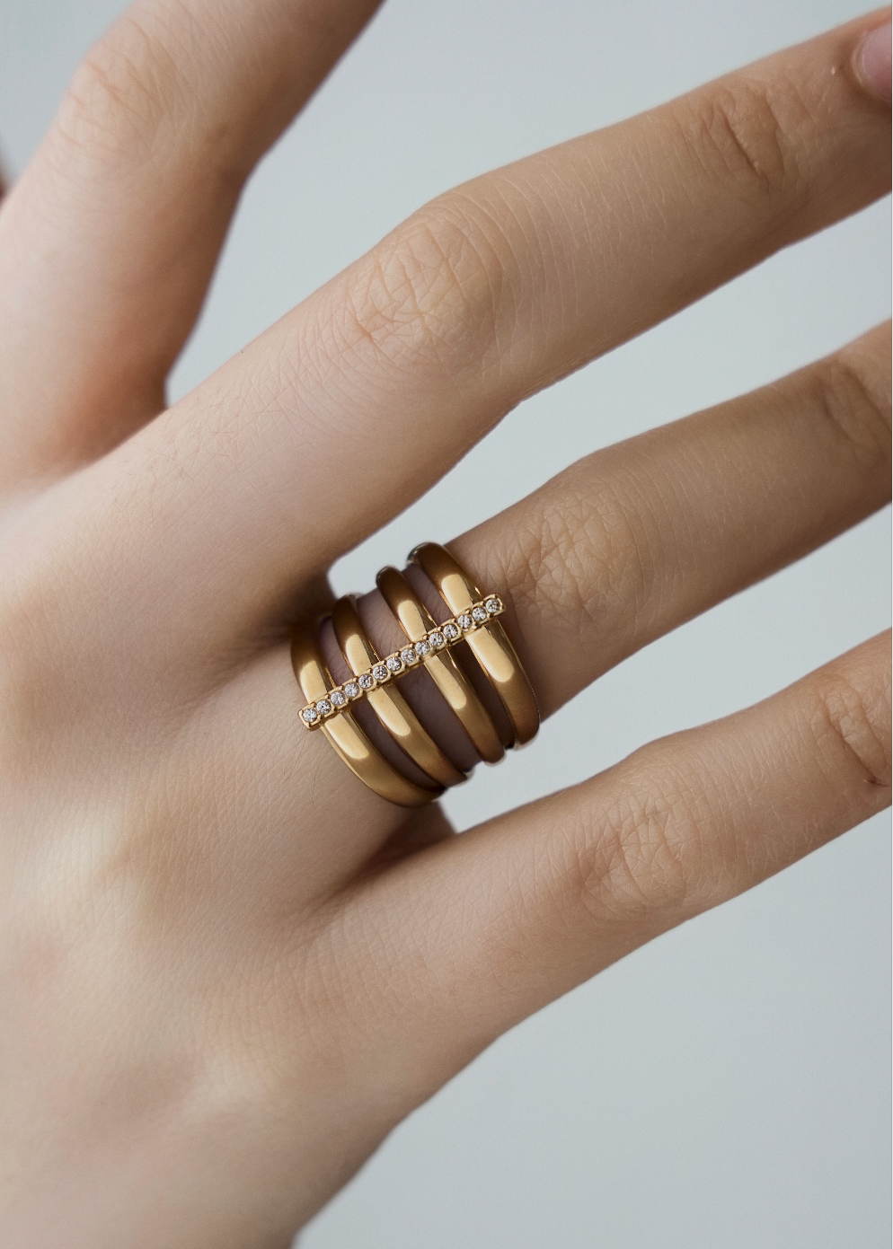 Anillo tira circnonitas